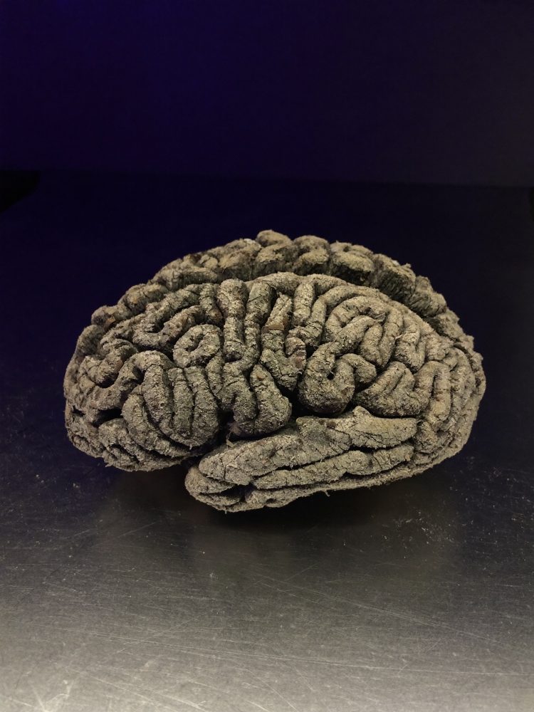A dry brain with residue packed into the folds