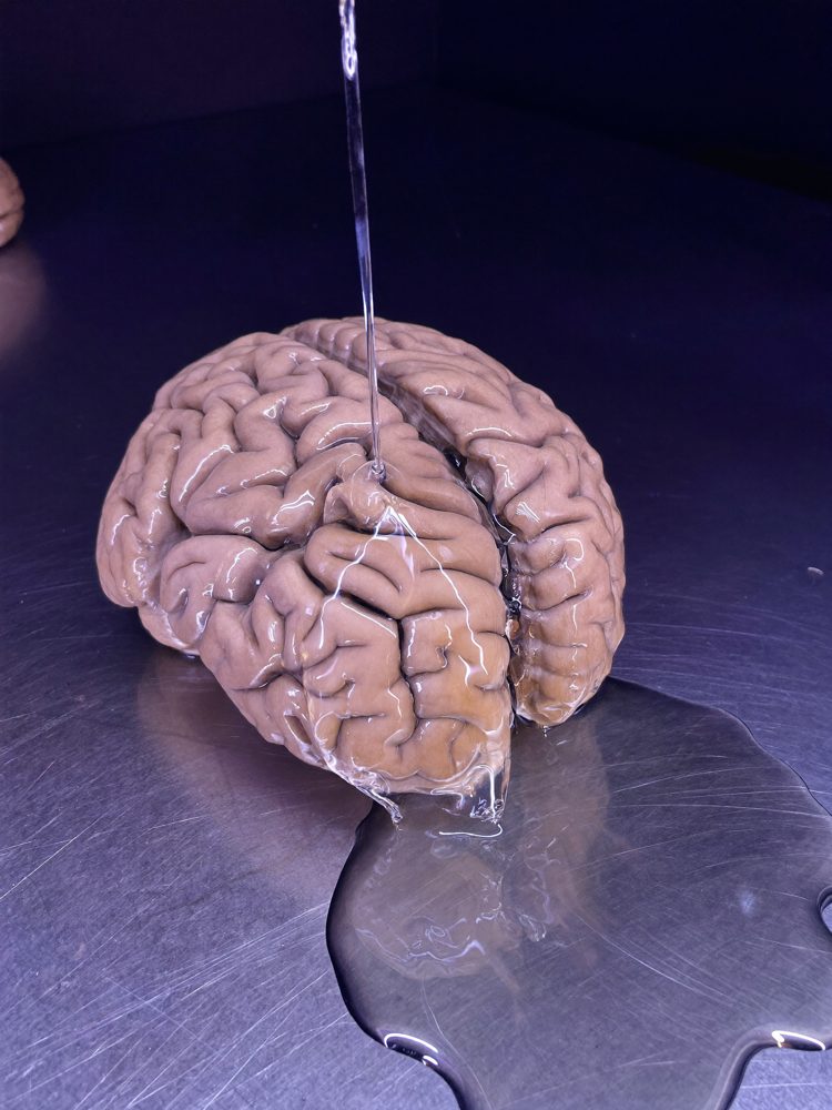 Fluid running over a brain on a steel surface