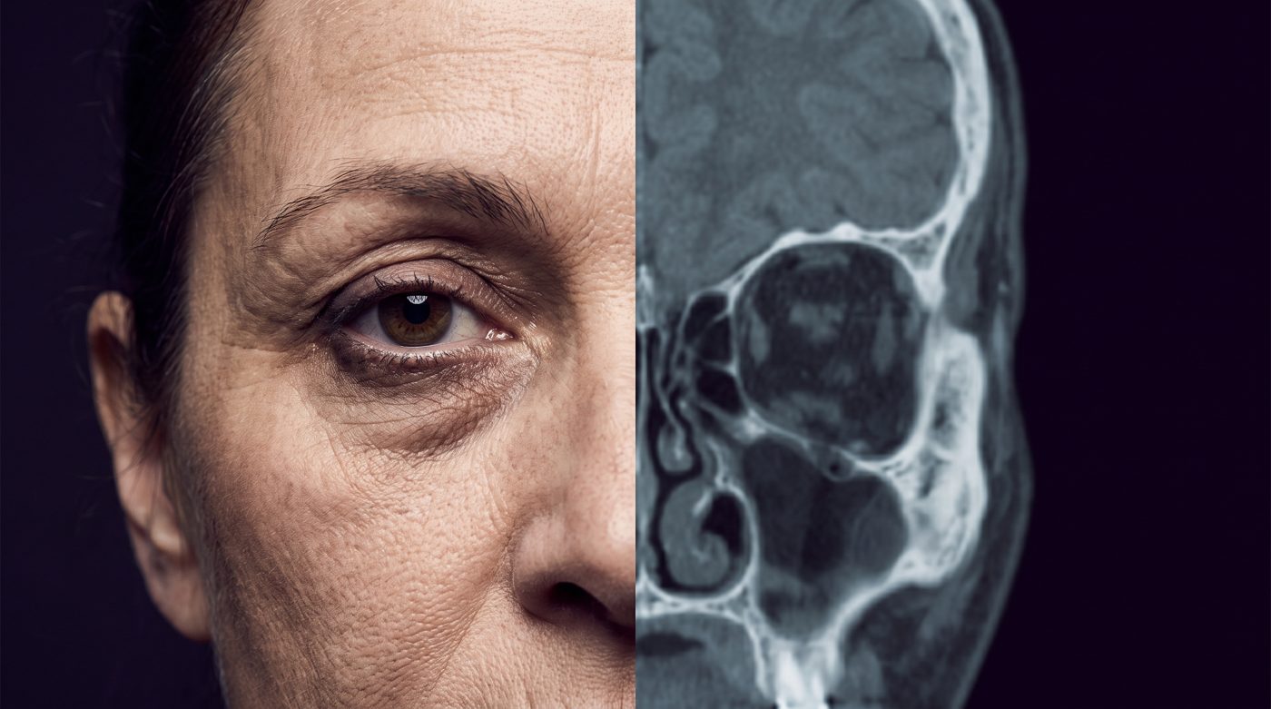 Tight editorial split of a tired face and a clinical scan